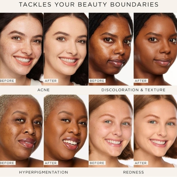 Tarte Shape Tape Concealer: Light Medium (29N), 5ml (Travel Size), New - Picture 7 of 8